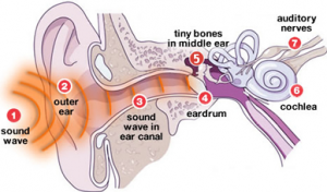 Deafness Autosomal Dominant