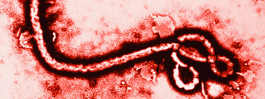 Ebola Replicates In Lungs, Says Research Study