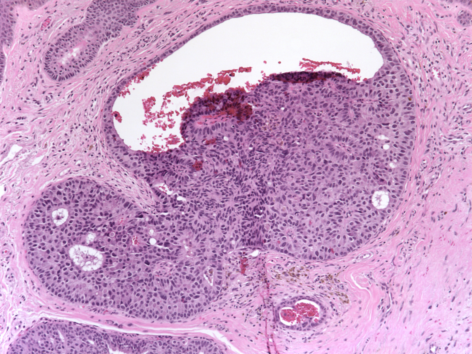 Endocrine Gland Neoplasms MyBioSource Learning Center